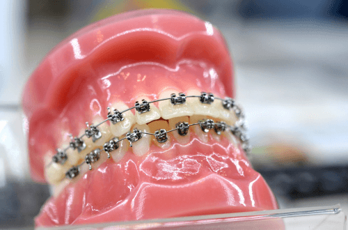 Neuromuscular Orthodontics