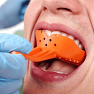 Custom Mouthguard Fitting