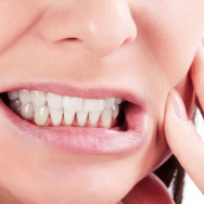 Teeth Grinding (Bruxism)