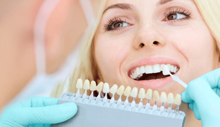 Cosmetic dentistry