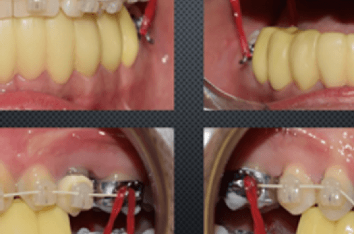 Neuromuscular Orthodontics